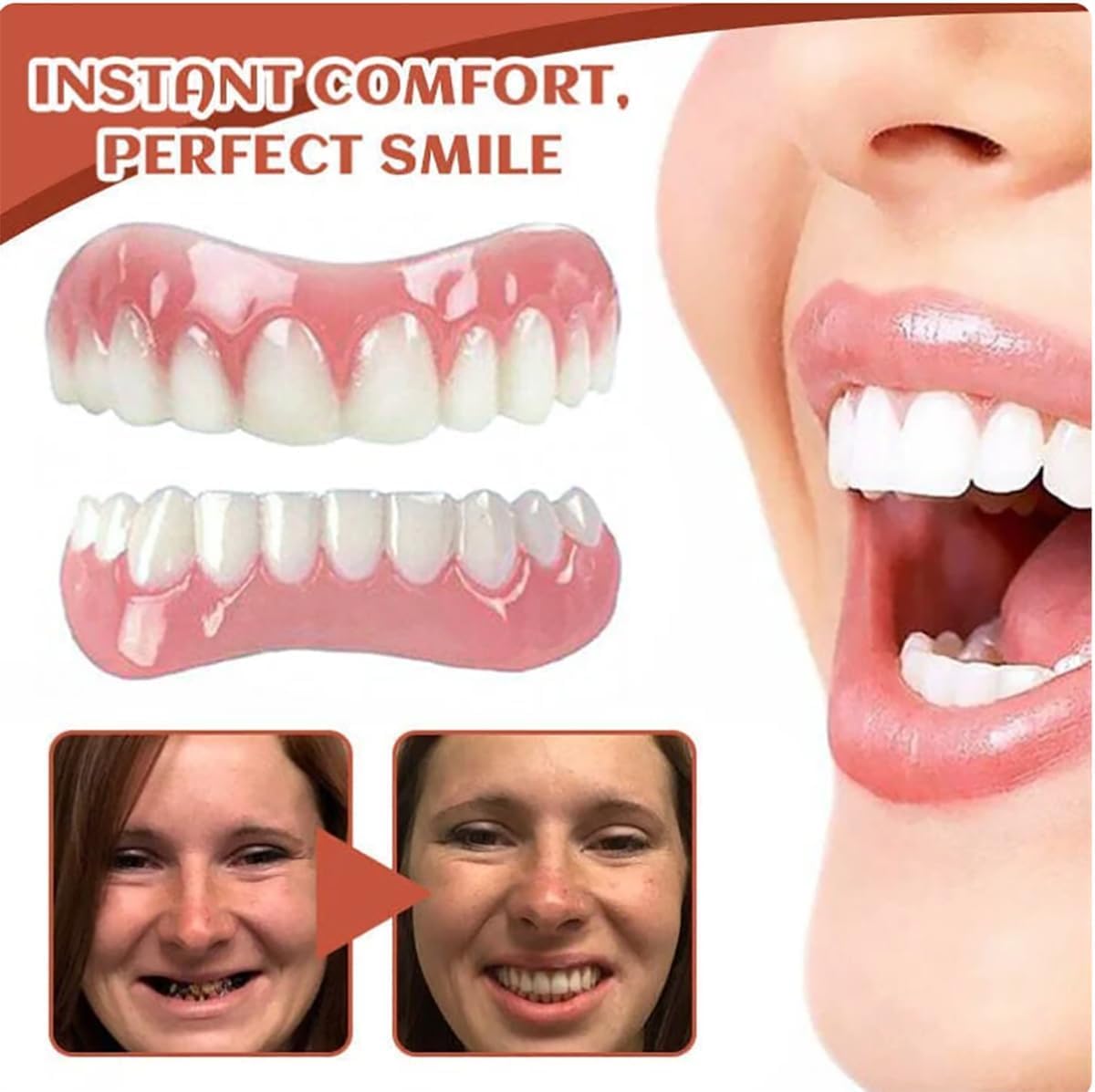 Silicone Denture Reline Kit 1 Set U2967